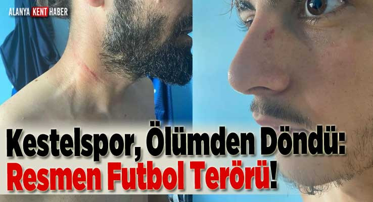 Kestelspor, Ölümden Döndü Resmen Futbol Terörü!